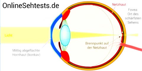 OnlineSehtests